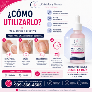 Anti Fungal Nail Treatment 30ml